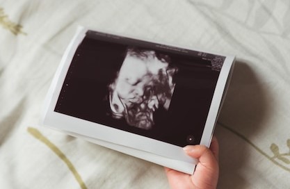 See Every Tiny Detail! With a 4D ultrasound